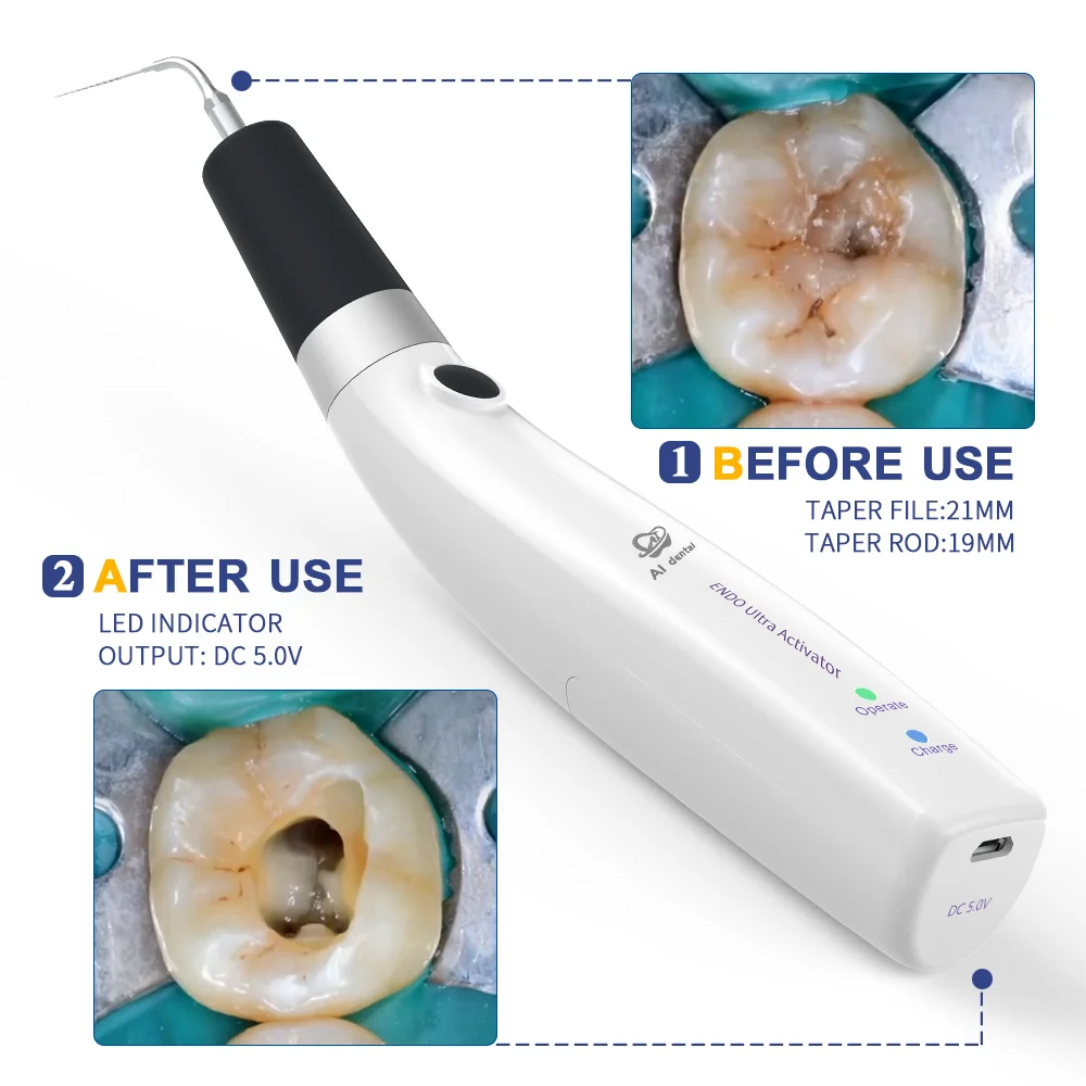 AI-Endo-IS citām zobārstniecības iekārtas, ultraskaņas irrigator handpiece sakņu kanālu ārstēšana, zobu medicīnas preces Attēls 3